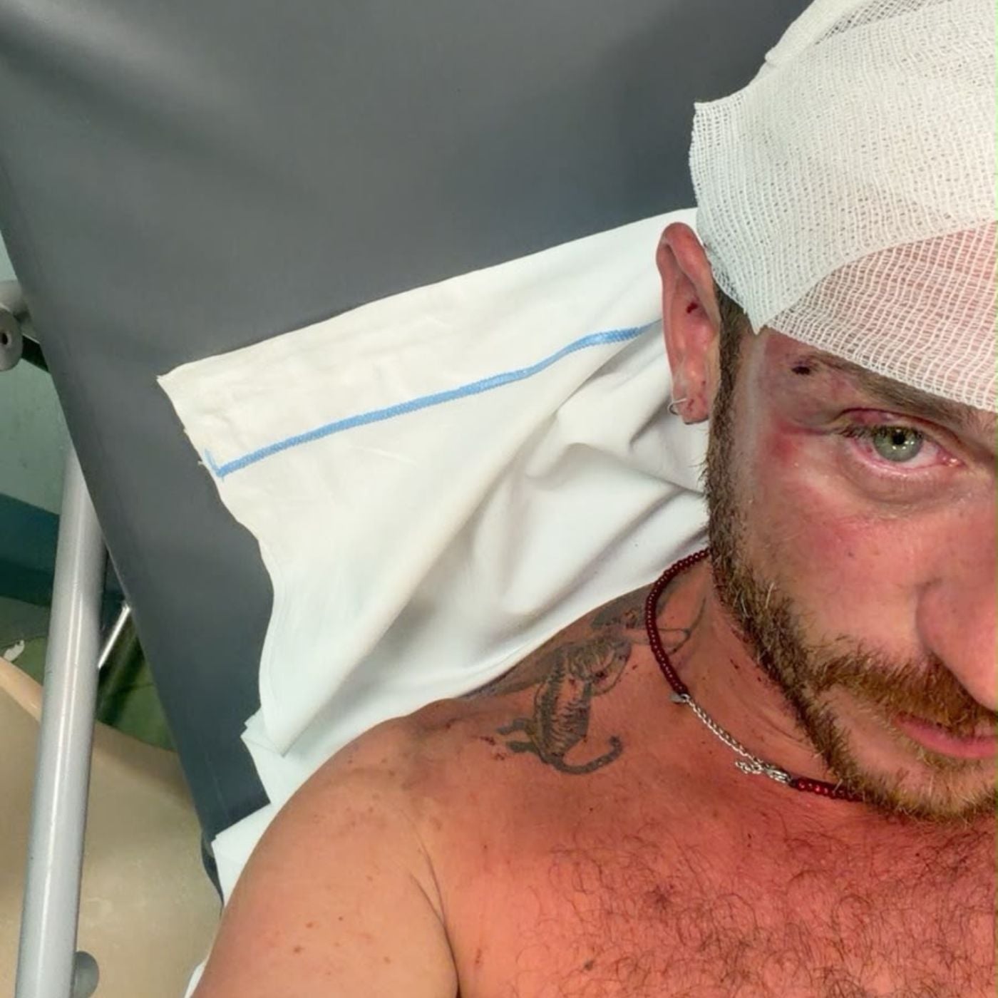 Picchiato perché gay. La denuncia di Angelo Ratti, aggredito vicino a Olbia da un branco di giovanissimi